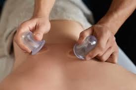 Cupping therapie